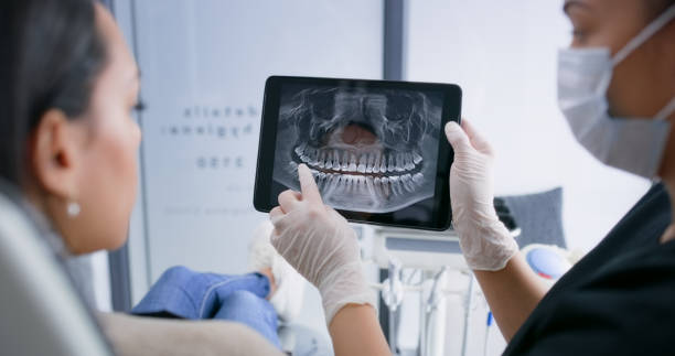 Licensed Teeth Whitening service in Cooper, TX - Smile Center Dentistry